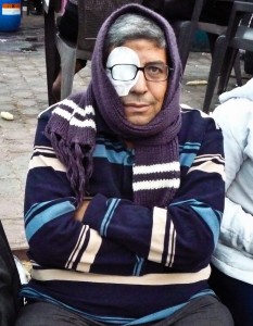 man-eyepatch.jpg